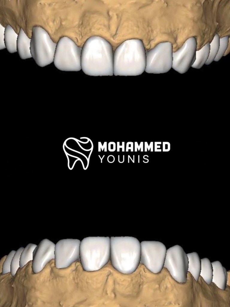 Luxury smile brand — white teeth
